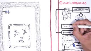 Hyponatraemia Hyponatremia  classification causes pathophysiology treatment [upl. by Pryce]