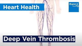 How deep vein thrombosis DVT forms  Bupa Health [upl. by Georgie]