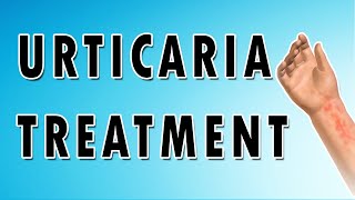 Urticaria Symptoms Treatment and Causes [upl. by Huberty270]