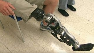 Bionic leg can read brain signals to walk [upl. by Eedyak233]