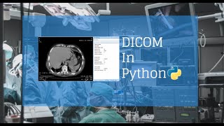 3 Dicom files to Image [upl. by Mallorie]