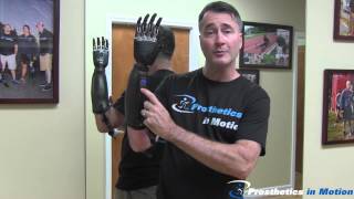 Below The Elbow Amputee Demonstrates BeBionic 3 Myoelectric Prosthesis [upl. by Aurlie]