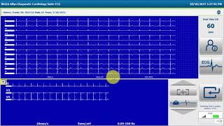 Welch Allyn® Diagnostic Cardiology Suite™ Resting ECG Workflow [upl. by Egbert]