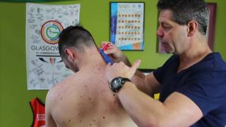 Trigger Point Therapy  Taping for Levator Scapulae [upl. by Nodearb]