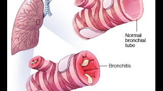 Demonstration Lung Auscultation [upl. by Antipus423]