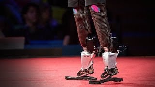 New bionics let us run climb and dance  Hugh Herr  TED [upl. by Hutchings]