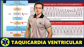 External Ventricular Drainage EVD and ICP Monitoring [upl. by Eenttirb]