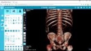 Viewing in 3D  postDICOM Free DICOM Viewer [upl. by Ciel]