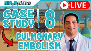 Case Study 8 Pulmonary Embolism [upl. by Ellekim]