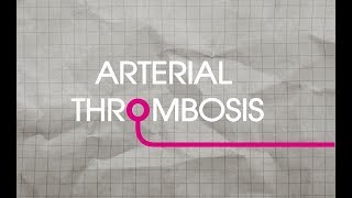 Arterial Thrombosis Explained [upl. by Radmilla504]