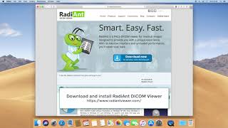 RadiAnt DICOM Viewer on macOS Mojave [upl. by Byram]