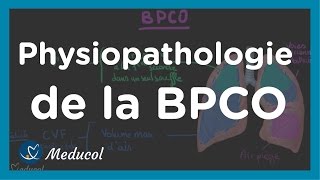 Emphysème pulmonaire et BPCO physiopathologie et causes [upl. by Hannie167]