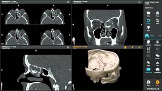 DICOM Viewer—Medical Image Manipulation [upl. by Georgette]