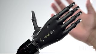 Top 5 bionic arm [upl. by Cyrilla]