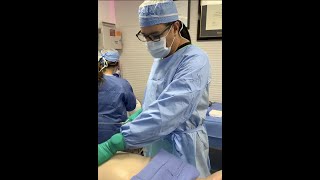 Skinny BBL with Awake Liposuction  Our Signature Procedure at Skin n Skinnier [upl. by Ushijima]