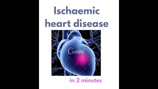 Ischemic Heart Disease in under 2 mins [upl. by Namhcan]