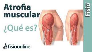 Atrofia muscular  Qué es y cómo sucede [upl. by Reisman]