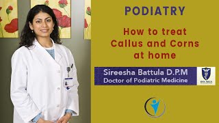 Callus and Corn Treatment at Home  Sanela Care  Dr Sireesha Battula [upl. by Garratt]