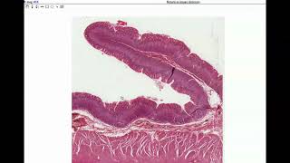 Anatomy  Histology of the Stomach amp Small Intestine [upl. by Avis]