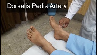 Dorsalis Pedis Artery Clinical Examination [upl. by Rothschild18]