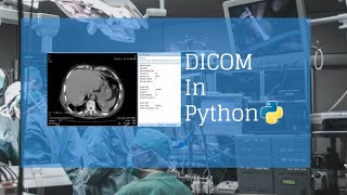 1 Dicom In Python [upl. by Studner669]