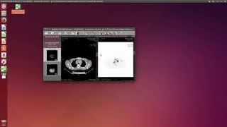 RadiAnt DICOM Viewer on Linux [upl. by Mctyre]