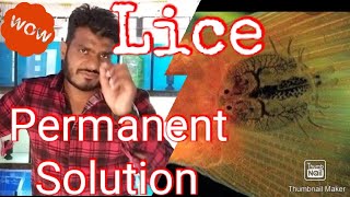 Aquarium lice Argulus complete guide  Solution [upl. by Ynnor393]