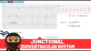 Rate and Rhythm  Junctional and Idioventricular Rhythm [upl. by Ellirehs509]