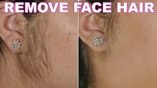 How To Remove Facial Hair Naturally  SkinCare Home Remedy  ShrutiArjunAnand [upl. by Amadus]