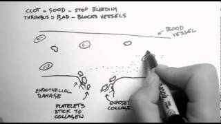 Haemostasis 1  Clots Thrombi amp Antiplatelets [upl. by Nrubua96]