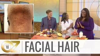 Causes and Solutions for Facial Hair in Women [upl. by Asek596]