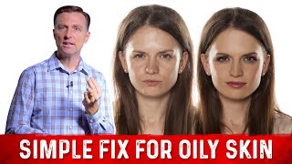 How To Fix Oily Skin With Simple Hack – Dr Berg [upl. by Lawton678]