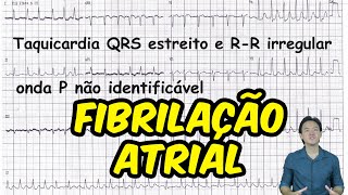 Cardioversion of Atrial Flutter [upl. by Inwat]