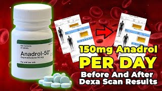 150 mg Anadrol PER DAY Before And After Dexa Scan Results [upl. by Leiba]