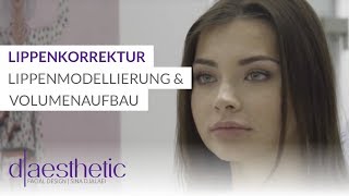 Lippenkorrektur mit Hyaluronsäure  Lippenmodellierung und Volumenaufbau  daesthetic [upl. by Clough337]