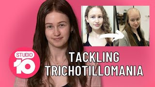 Tackling Trichotillomania  Skye Opens Up About Her Struggle With HairPulling Disorder  Studio 10 [upl. by Nail107]