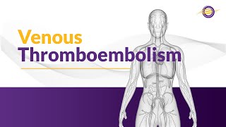 What is Venous Thromboembolism [upl. by Lindon]