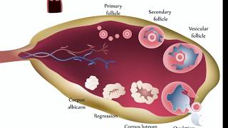 Ovarian Cysts [upl. by Geller]