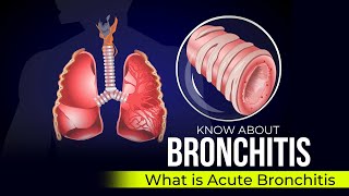 Bronchoscopy Procedure South West Acute Hospital [upl. by Lillywhite874]