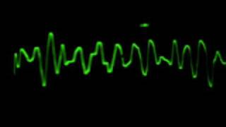 EKG Fibrilación Ventricular [upl. by Aracot24]