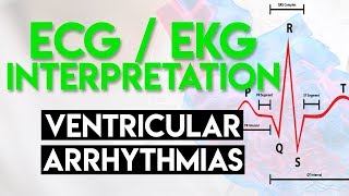 Ventricular Rhythms  EKG Interpretation  LevelUpRN [upl. by Isbella872]