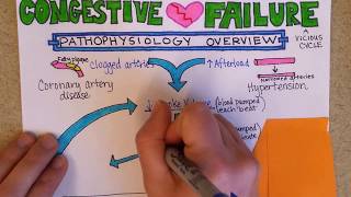 Congestive Heart Failure Pathophysiology [upl. by Angele]