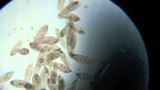 Paramecium Under the Microscope [upl. by Ruthie]